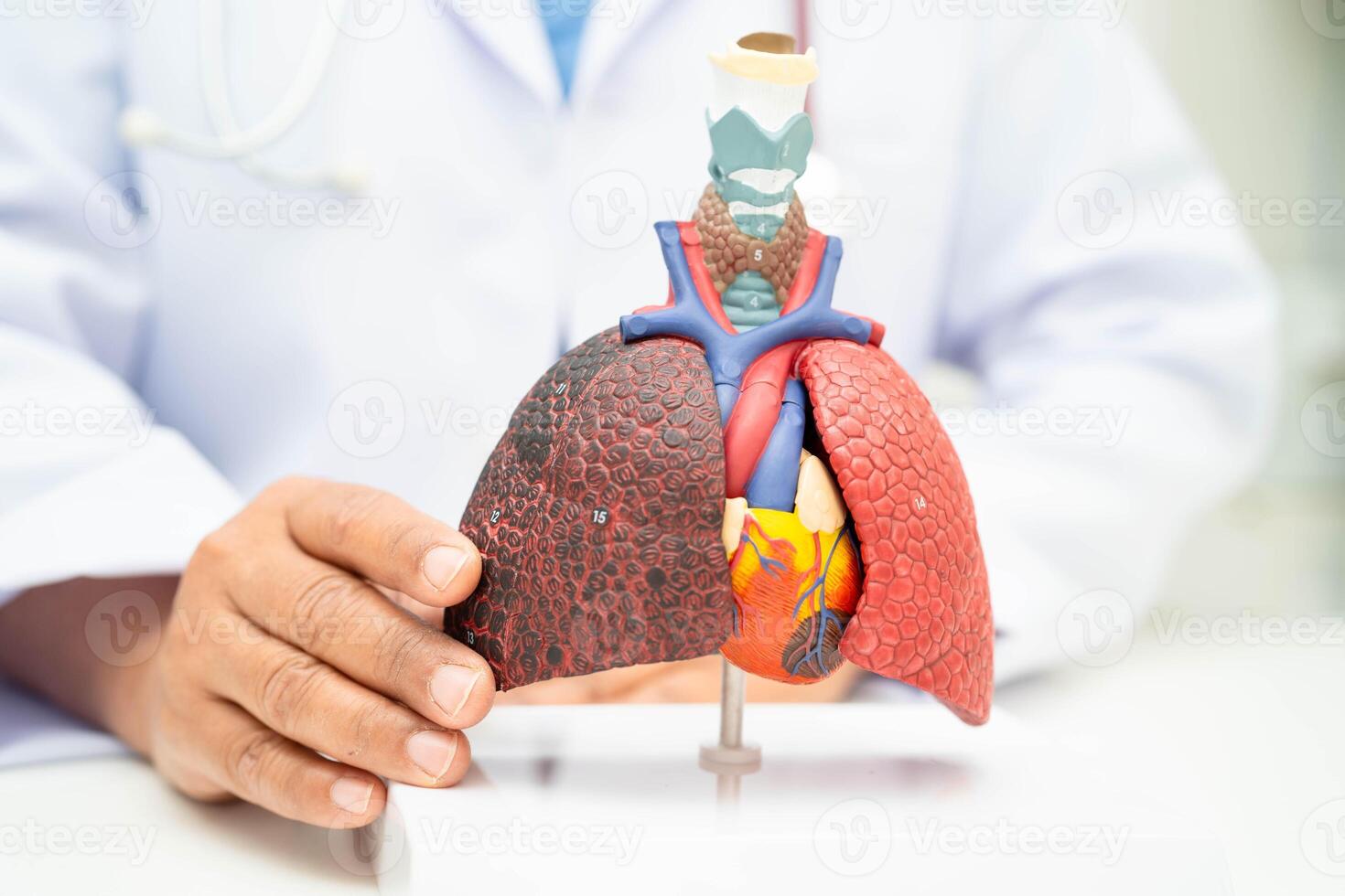 Pneumonia, lung cancer, Asian doctor holding human anatomy model for study diagnosis and treatment in hospital. photo