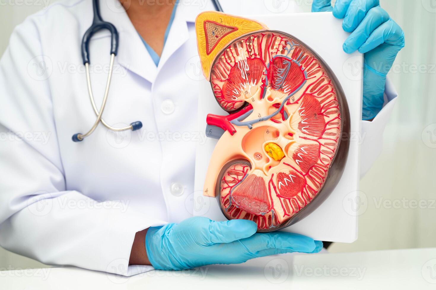 Chronic kidney disease, doctor with model for treatment urinary system, urology, Estimated glomerular filtration rate eGFR. photo