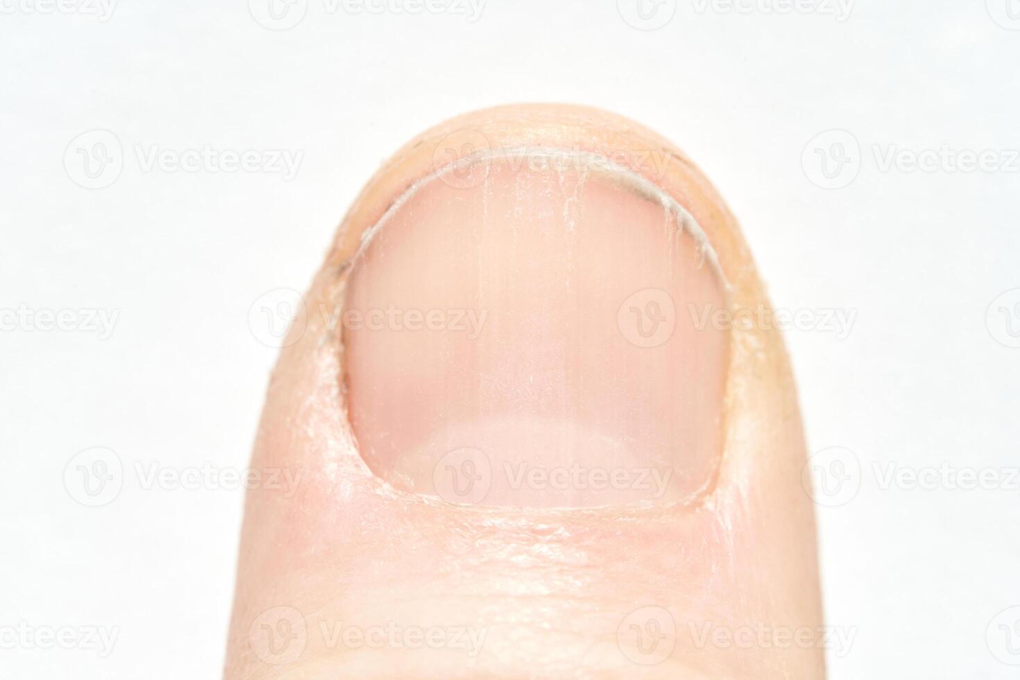 Close up of a human fingernail displaying natural texture and detail on white background. photo