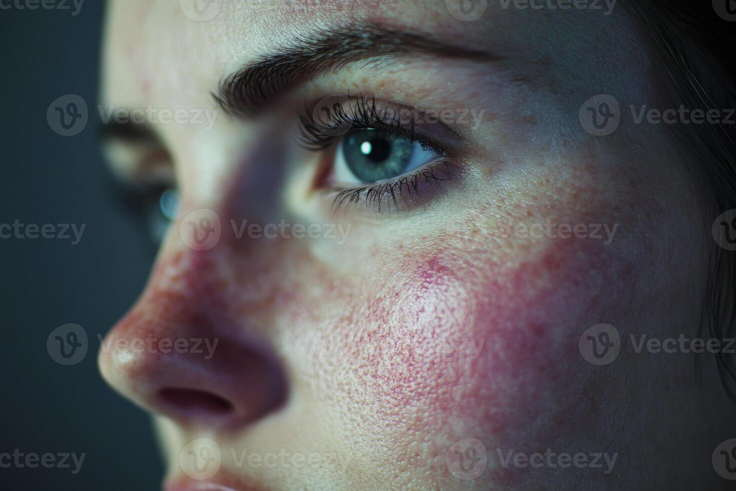 Close-up of a young woman's face highlighting unique skin texture and features photo