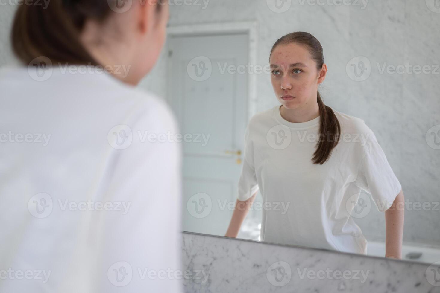 Gen z woman looking at her acne and post-acne marks, stands before a mirror in bathroom. Concept of acne treatment, skincare, adult acne photo