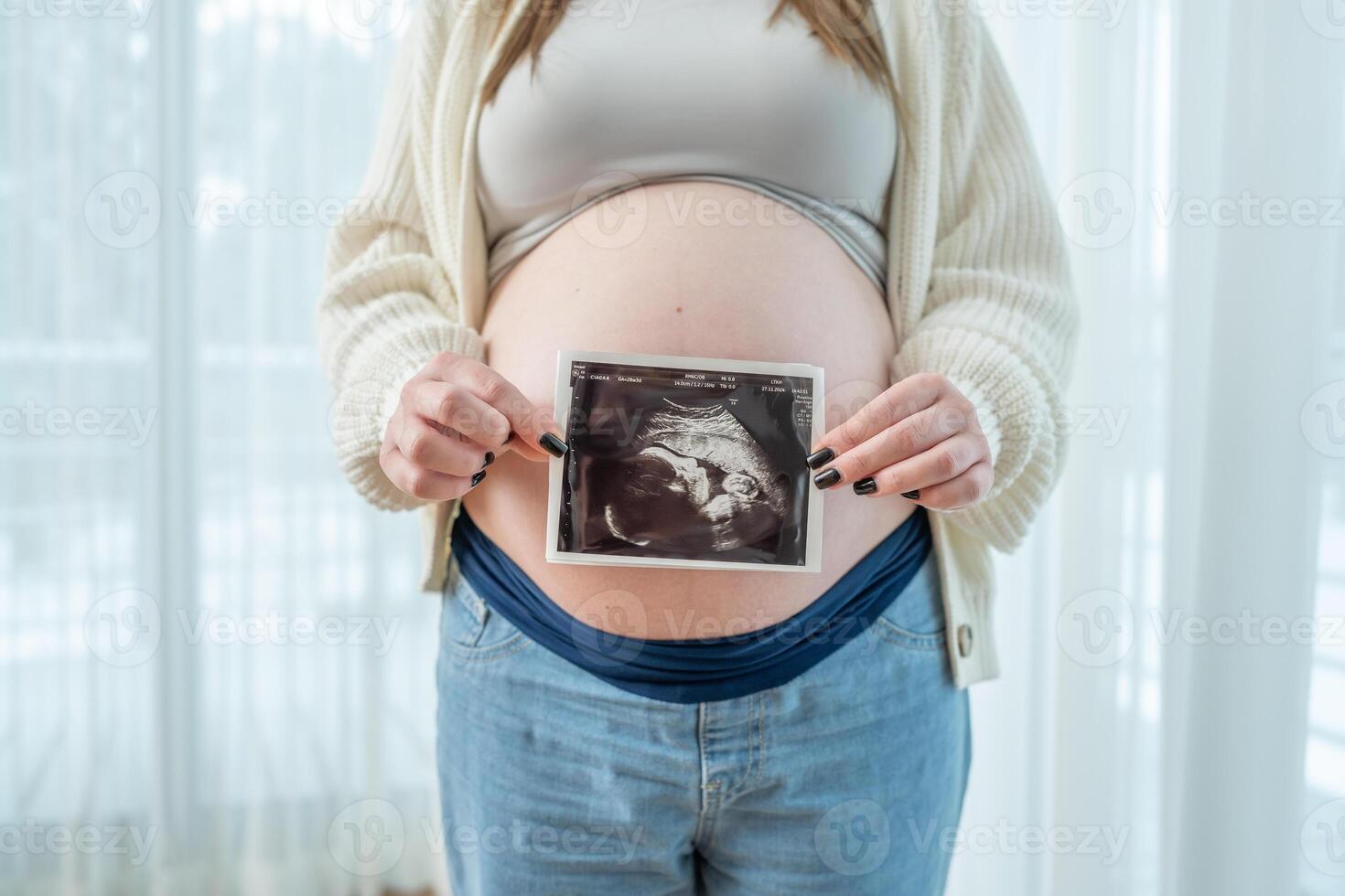 Young pregnant woman holding ultrasound scan photo of a fetus in front of her belly in third trimester at home. Concept of pregnancy, sonography. Maternity prenatal care