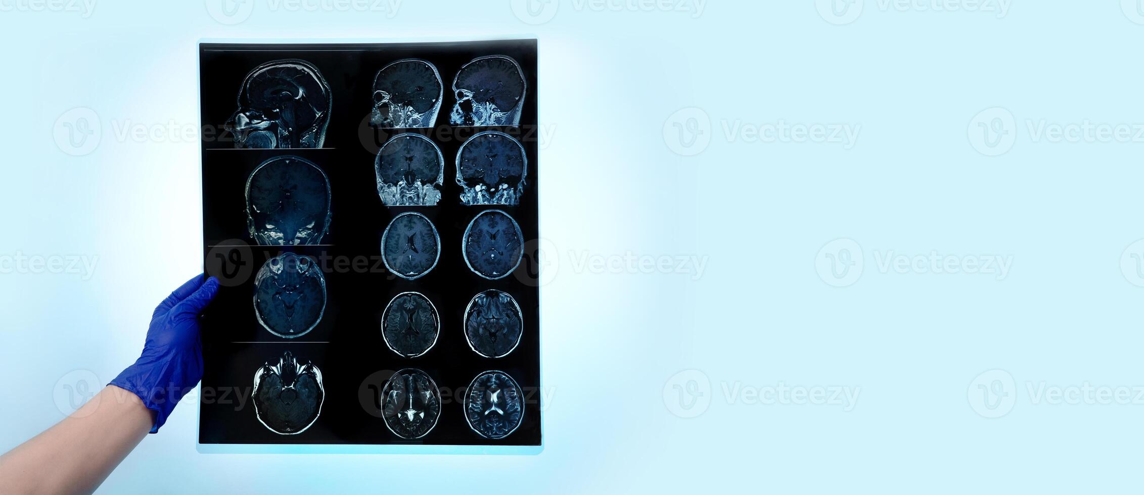 doctor holding brain MRI panoramic layout photo