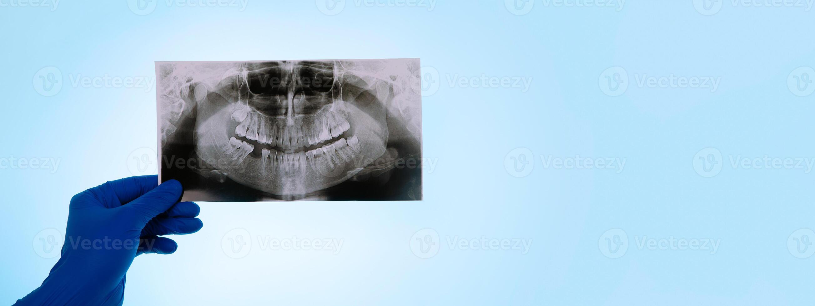 dentist holding snapshot the patient's tooth photo