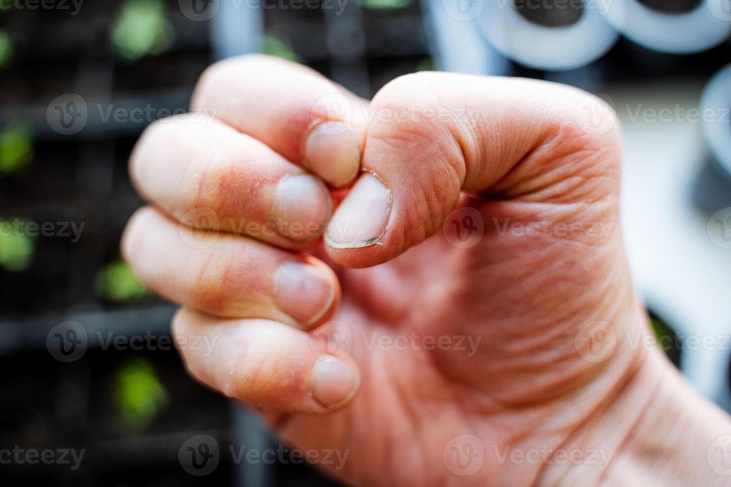 Closeup macro photography capturing detailed texture of human hand skin, nails, thumb, and fingers. Shows anatomy, health, skincare, and dermatology aspects of the hand photo