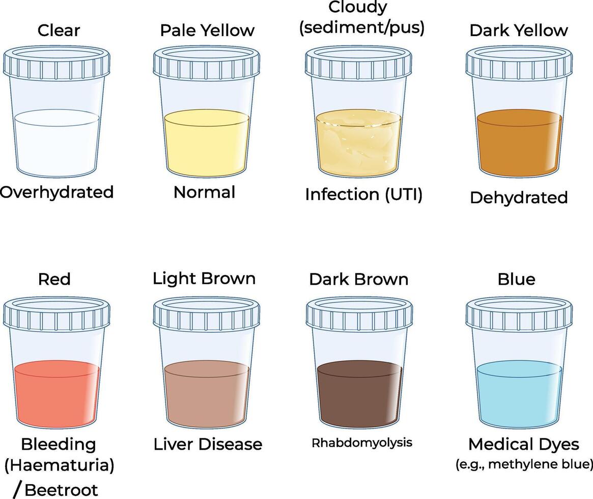 Urine colors meaning diagram vector