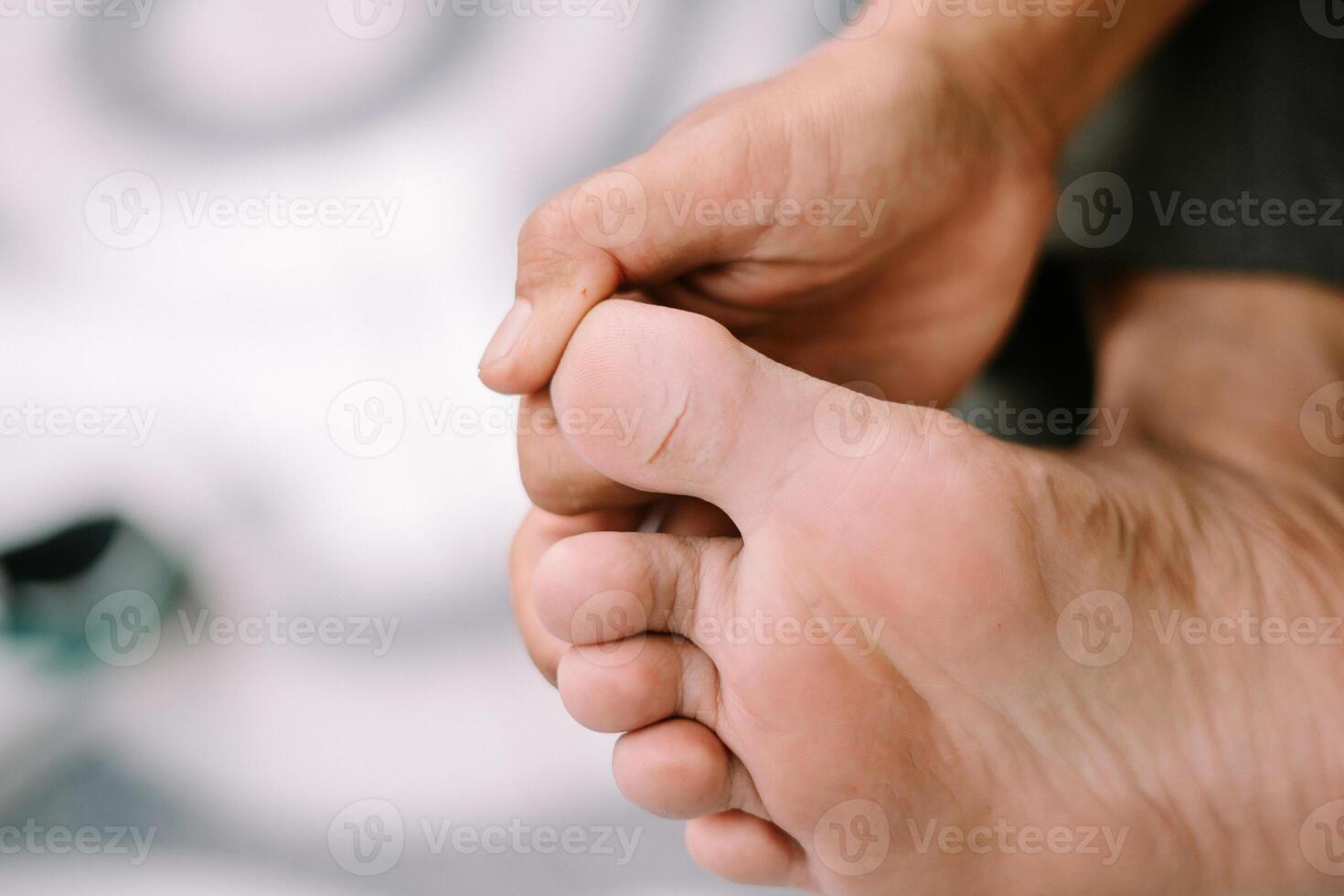 Close-up of a cracked and dry skin on the sole of a big toe photo