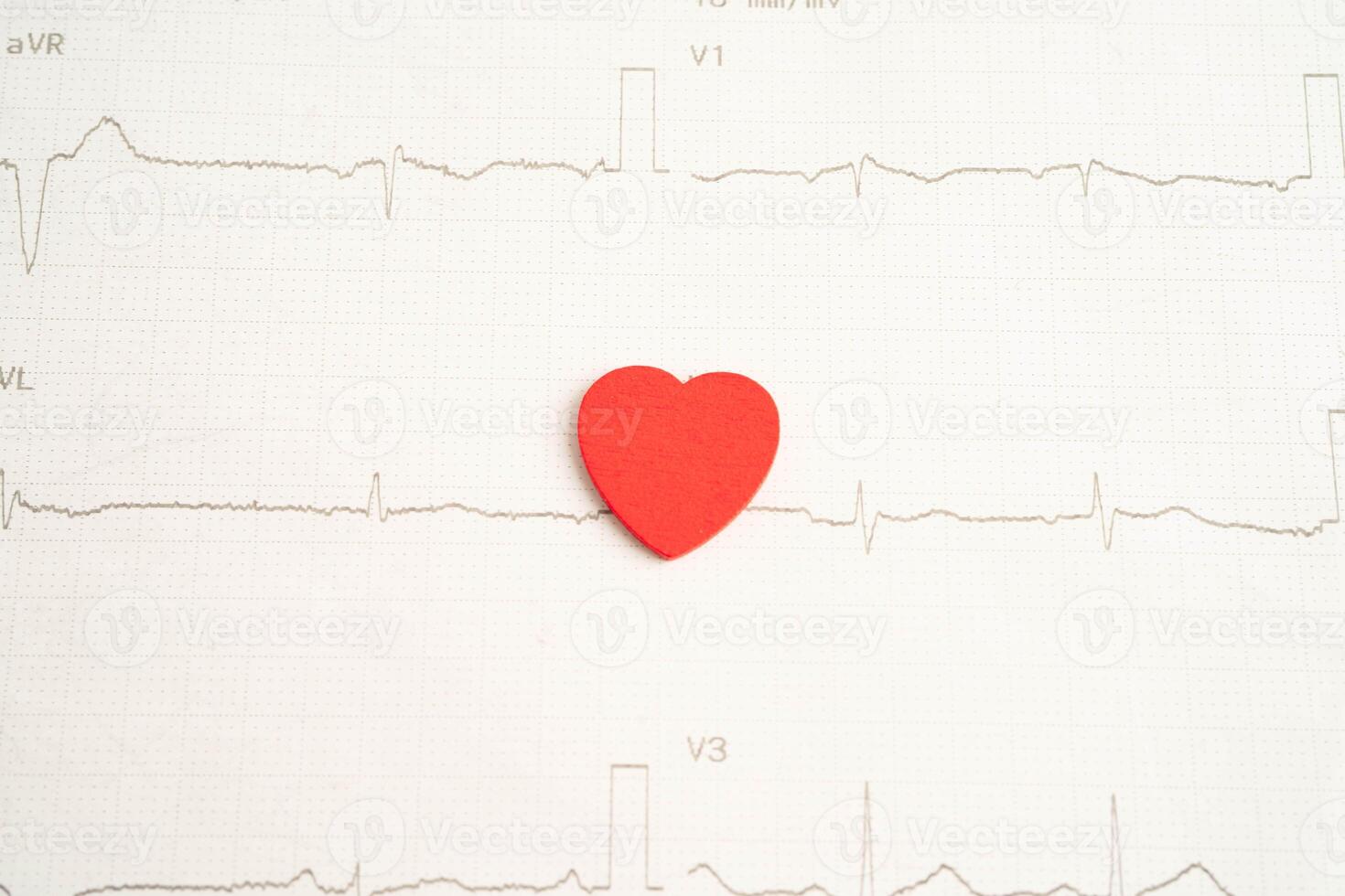 Electrocardiogram ECG, heart wave, heart attack cardiogram report. photo