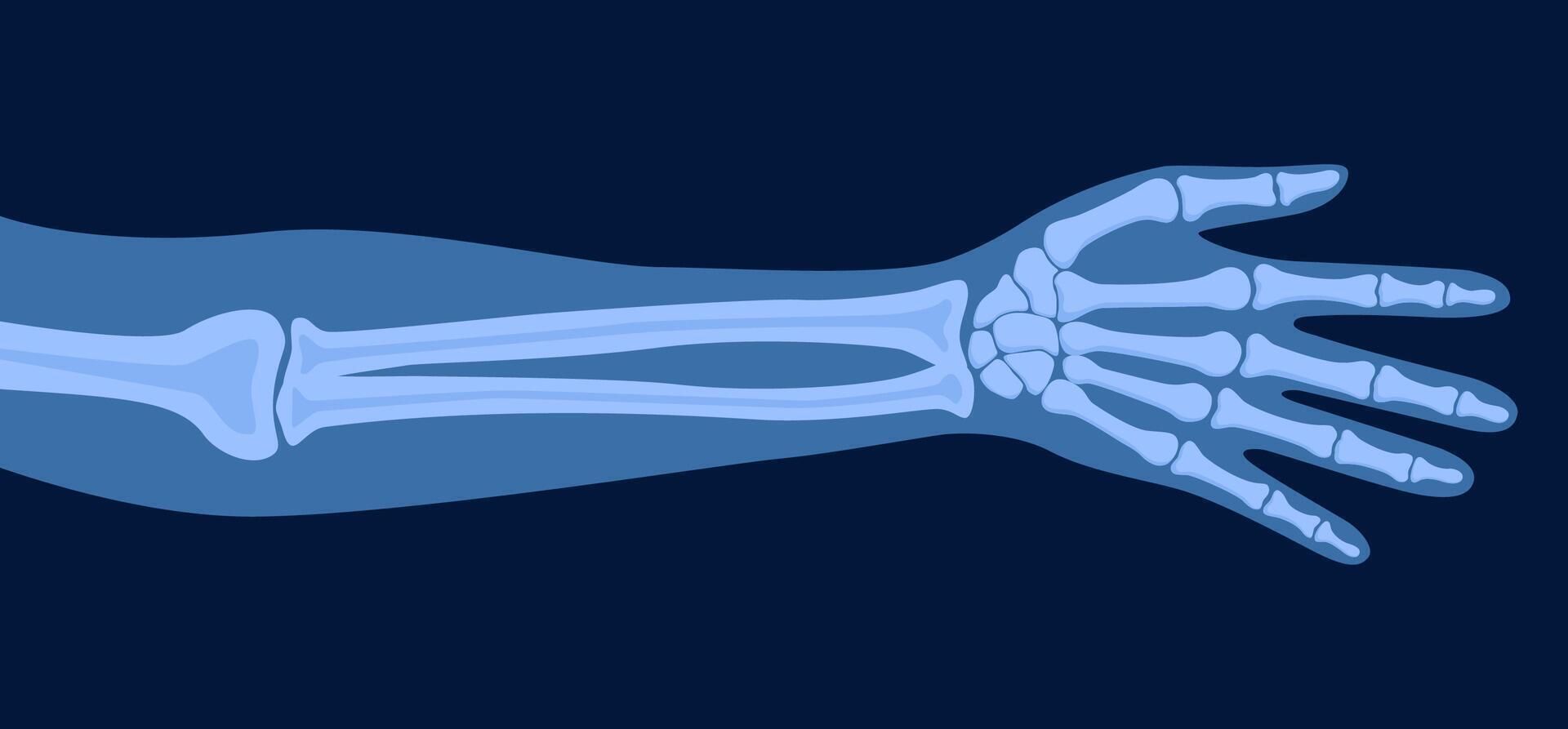 X ray of human hand. Body bone roentgen front view. Medical anatomy. Arm checking healthcare joint palm finger exam. Radiology scan MRI hospital traumatology. illustration vector