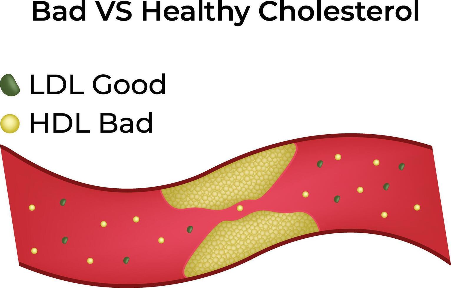 Bad vs Healthy Cholesterol Science Design Illustration Diagram vector