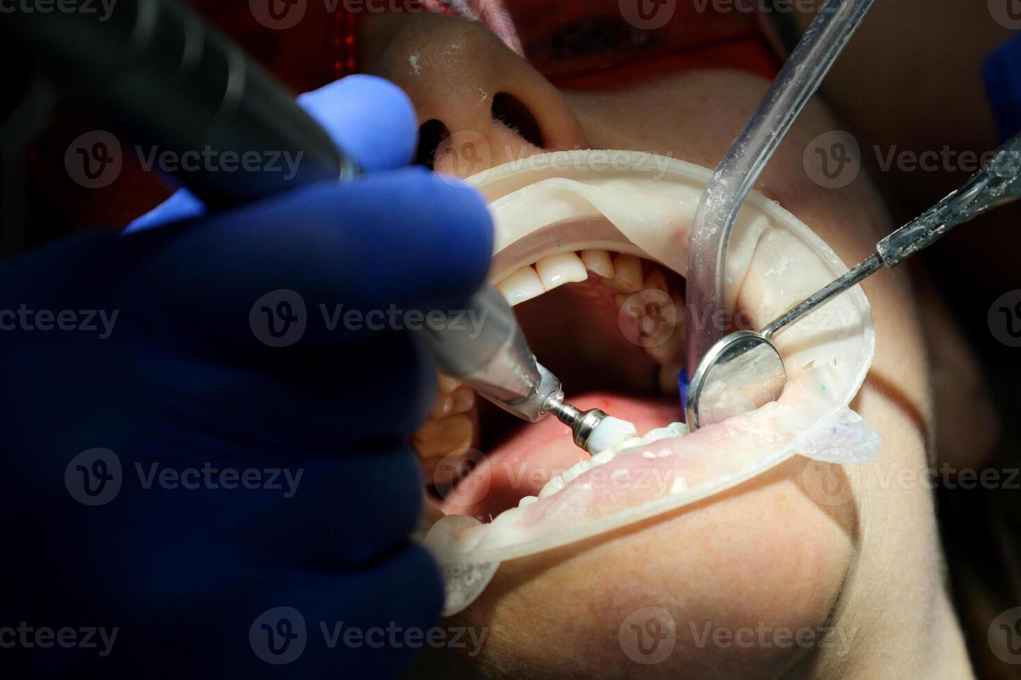 dental instruments Beautiful senior woman at dentist having dental treatment at dentist's office photo