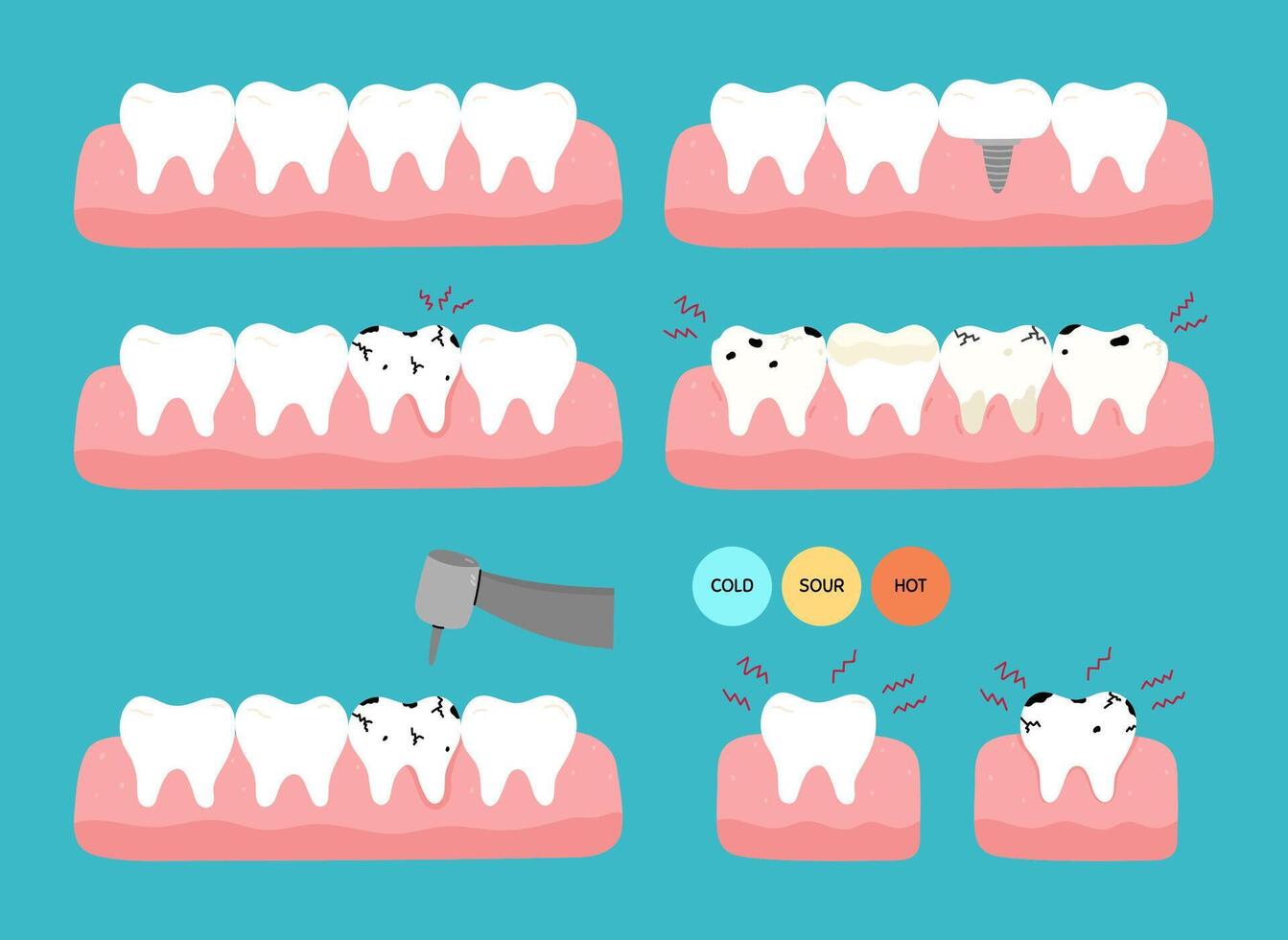 A set of teeth with various dental problems - caries, toothache, plaque, cracks, implant replacement, sensitivity. hand-drawn illustration in flat style. Dental treatment, oral hygiene concept. vector