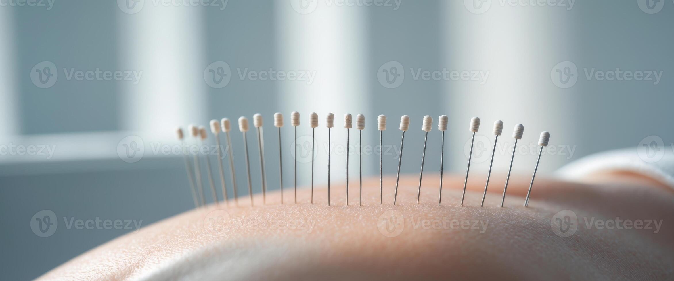 Close up of acupuncture needles in back clinic background. photo