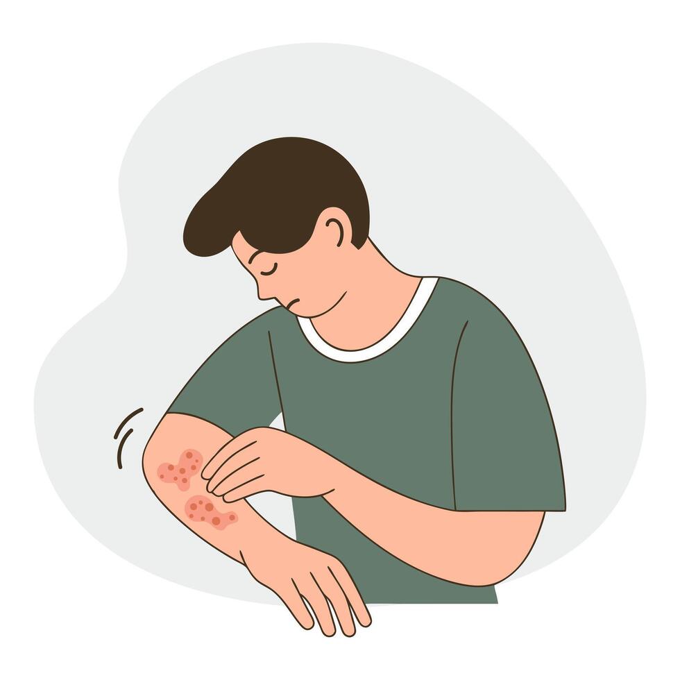 Man with itchy skin rash. Allergic itching, skin inflammation, redness. Healthcare and medicine. vector