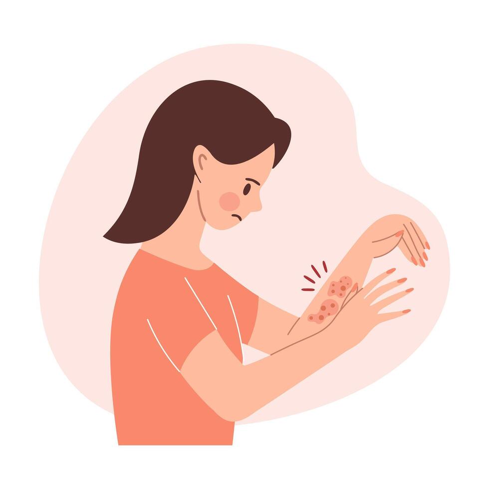 Woman with itchy skin rash. Allergic itching, skin inflammation, redness. Healthcare and medicine. vector