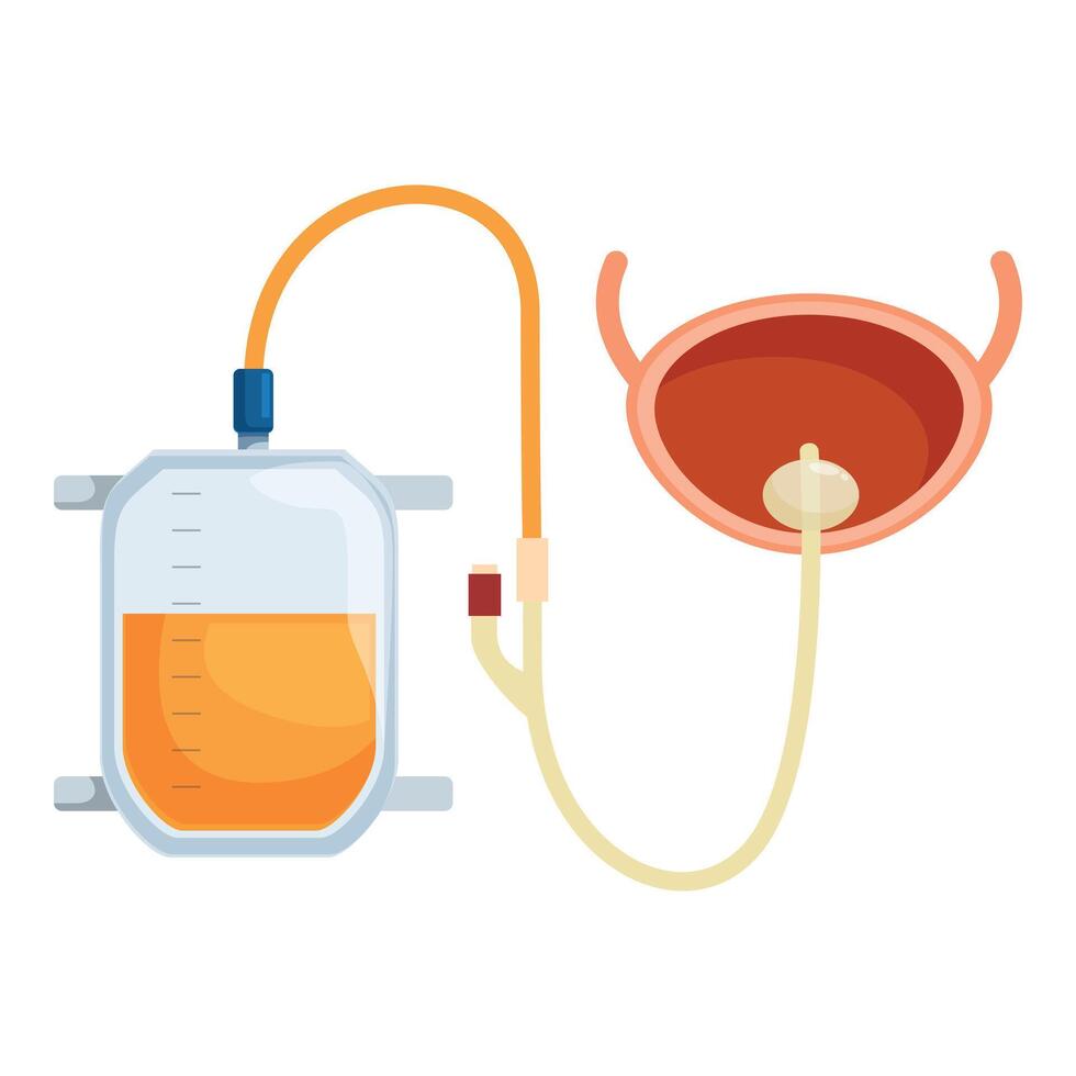 Urinary catheter draining urine into collection bag from bladder, medical device illustration vector