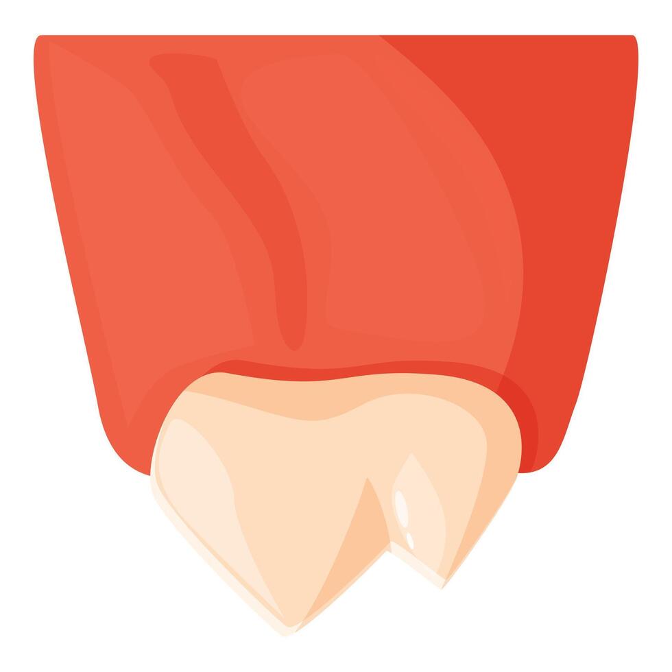 Inflamed gums exposing a broken tooth, dental health issues depicted vector