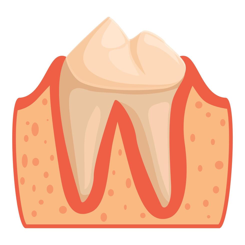 Periodontitis affecting tooth enamel and gum health illustration vector