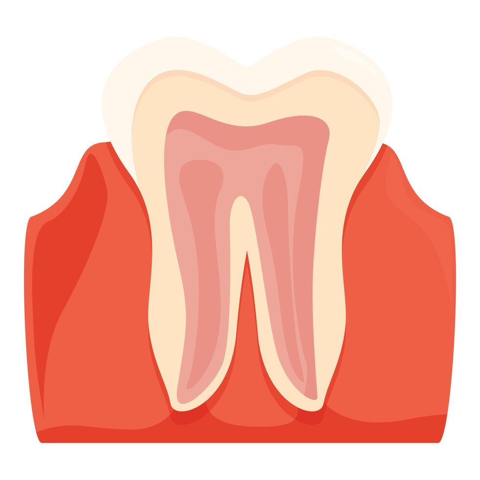 Periodontitis affecting human tooth and causing gum inflammation vector