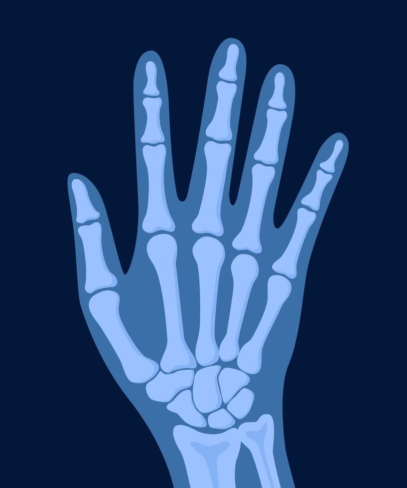 X ray human hand. Body bone roentgen front view. Medical anatomy. Arm checking healthcare joint palm finger exam. Radiology scan MRI hospital traumatology. illustration vector