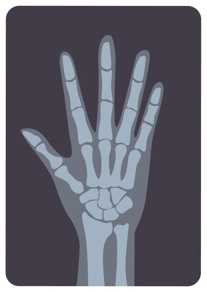 Radiograph, X-radiation picture or X-ray image of hand or palm with wrist and fingers. Modern medical radiography and human skeletal system. Monochrome illustration in flat cartoon style. vector