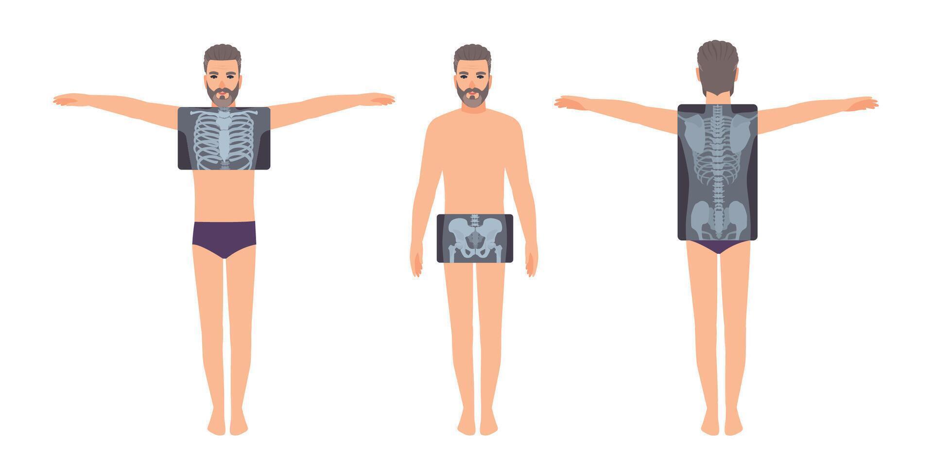Male patient and his chest, pelvis and back radiograph isolated on white background. Bearded man and X-ray pictures of his skeletal system on monitor. Flat cartoon colorful illustration. vector