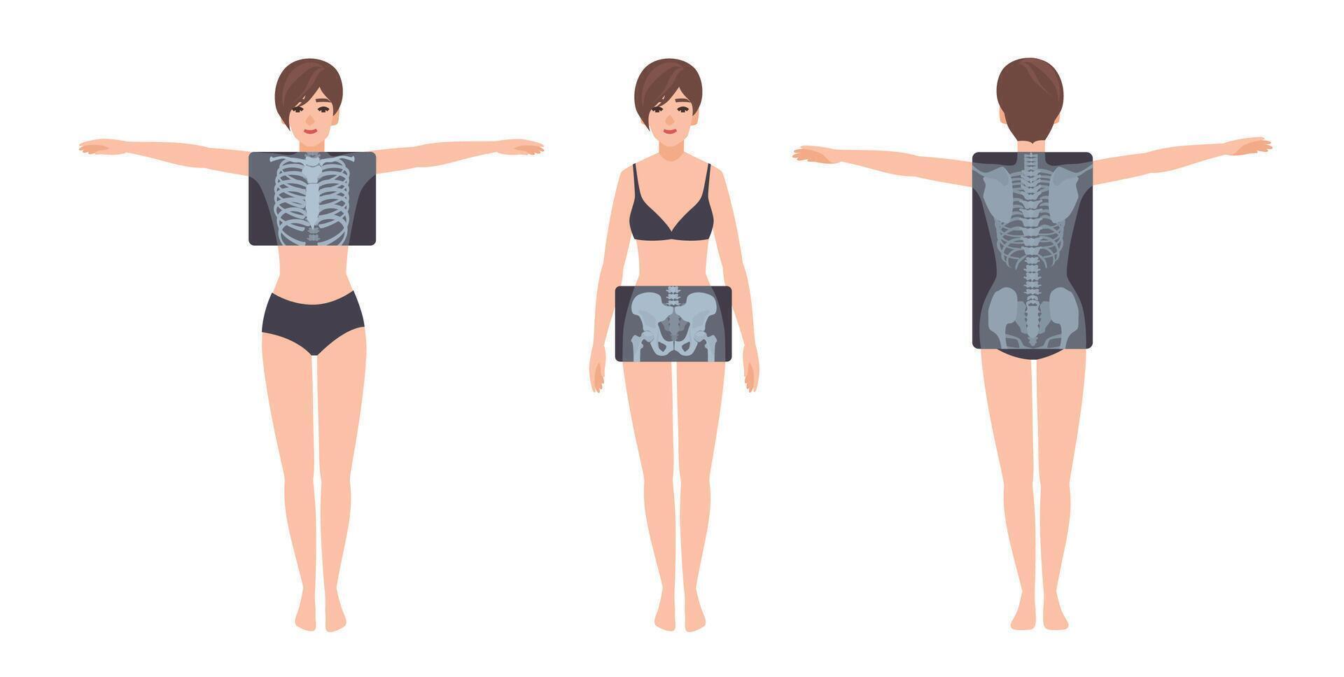 Female patient and her rib cage, pelvis and spine radiograph isolated on white background. Young woman and X-ray pictures of her skeletal system on monitor. Flat cartoon colorful illustration. vector