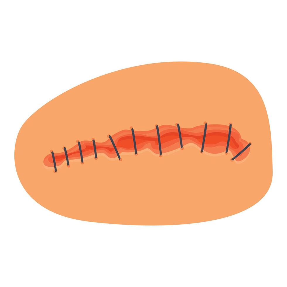 Surgical wound with stitches healing on skin surface vector
