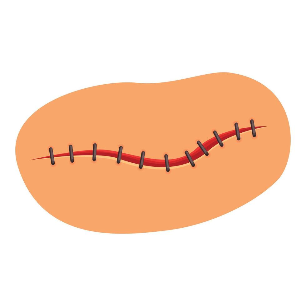 Healing skin with surgical stitches representing post operative care and recovery vector