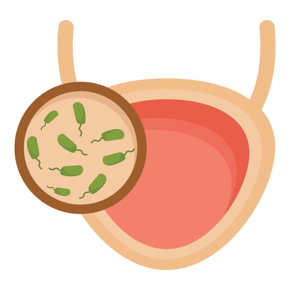 Bacteria colonizing human bladder, causing urinary tract infection vector