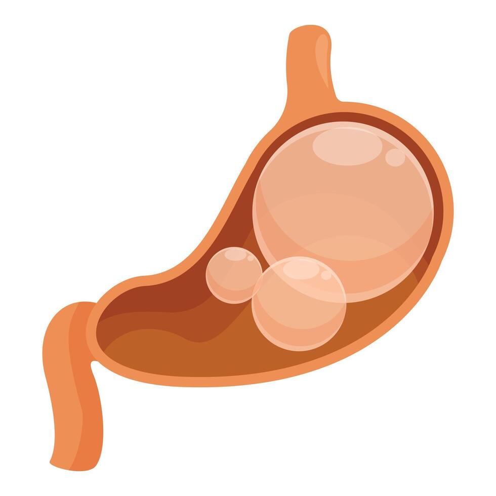 Stomach bloating causing abdominal distension, acid reflux and gas vector