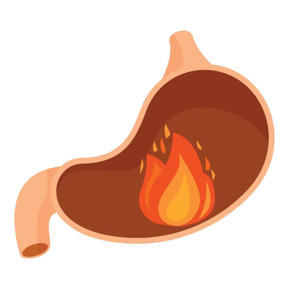 Burning stomach showing heartburn or gastritis symptom vector