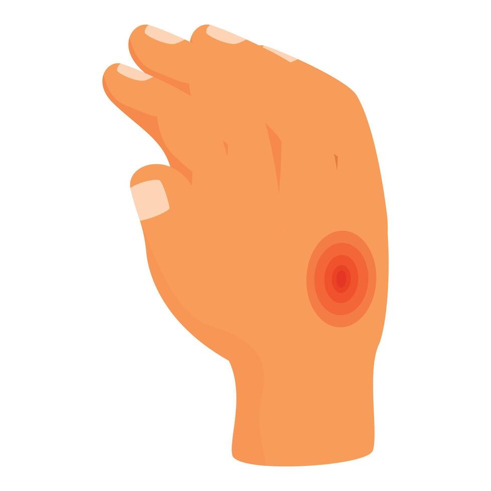 Hand showing skin rash or eczema symptoms vector