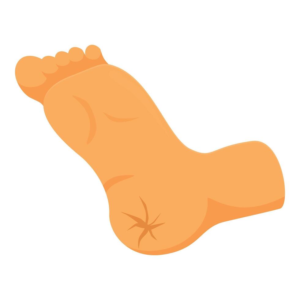 Dry skin on heel causing cracks and discomfort vector