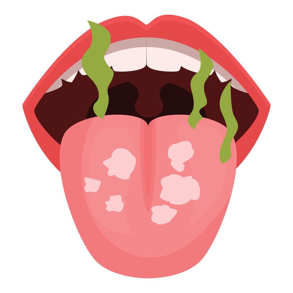 Open mouth showing halitosis and coated tongue representing oral problems vector