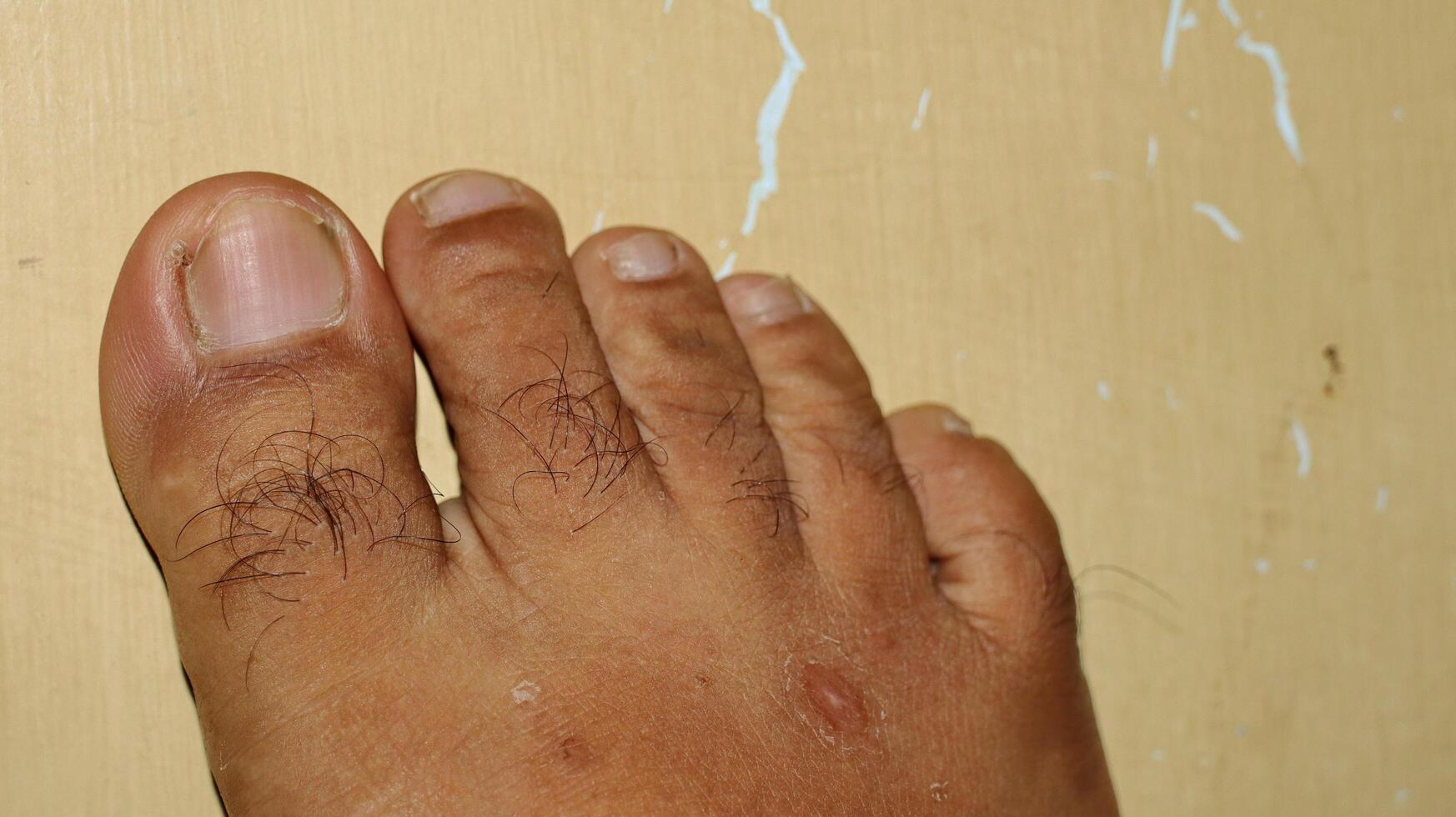 Close up of foot and dirty long toe nail photo