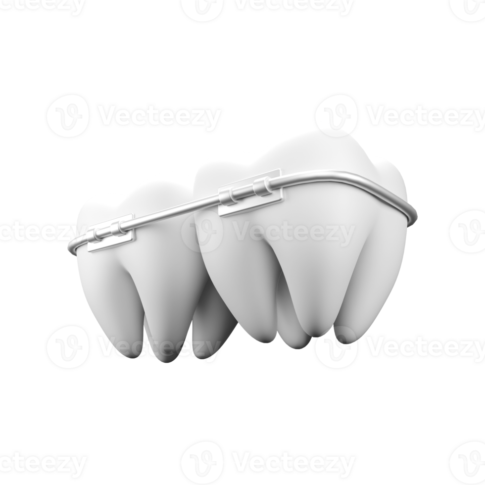 3d illustration of braces png