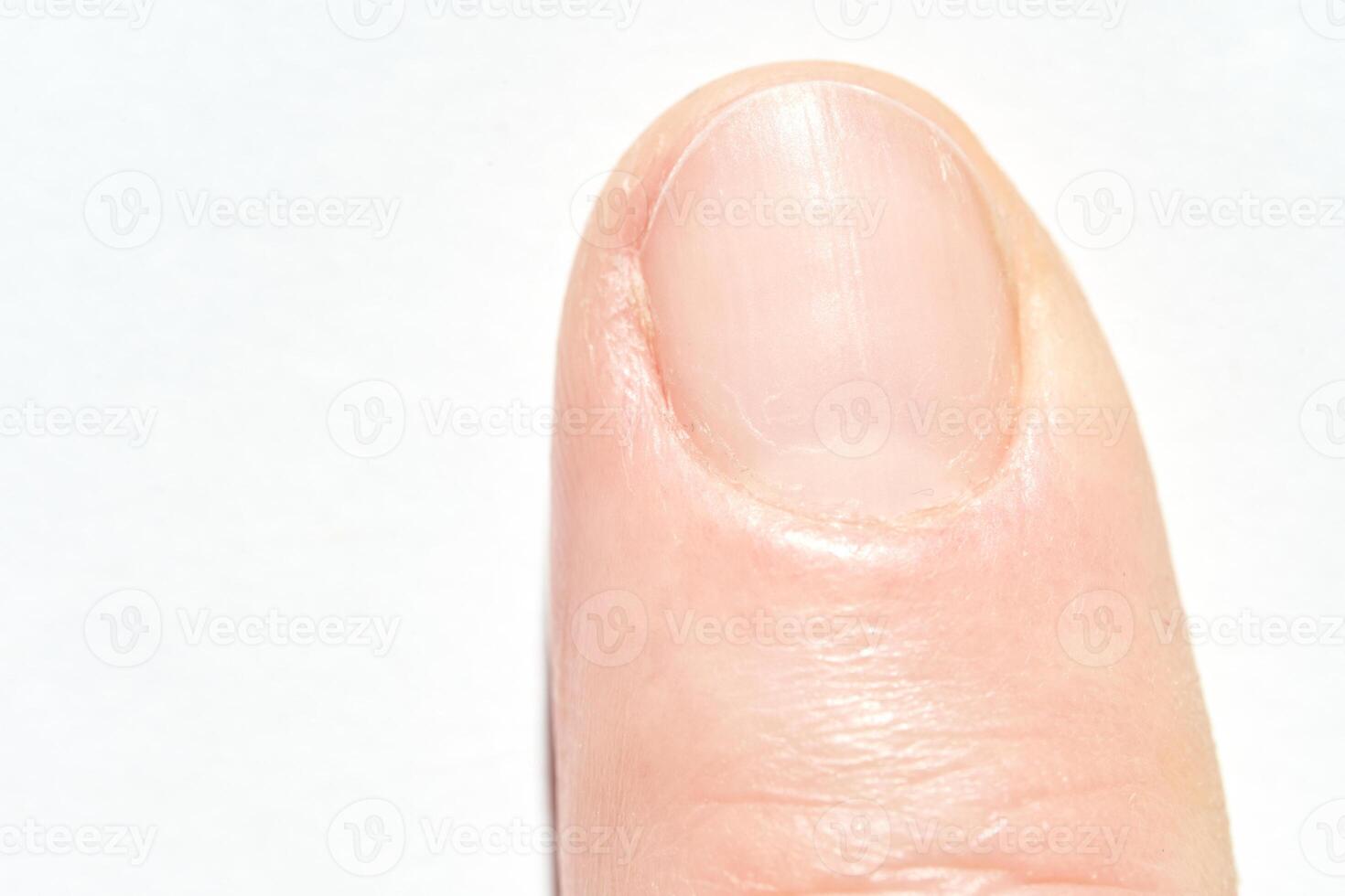 Close up of a caucasian adult finger with visible fingernail on white background. photo