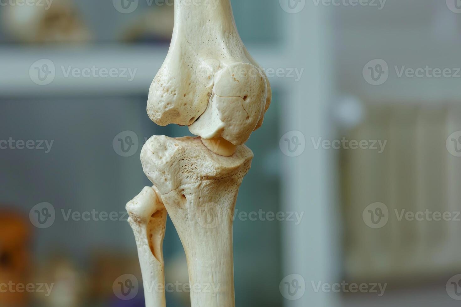 Artificial human knee joint showing femur, tibia, fibula, and patella bones photo