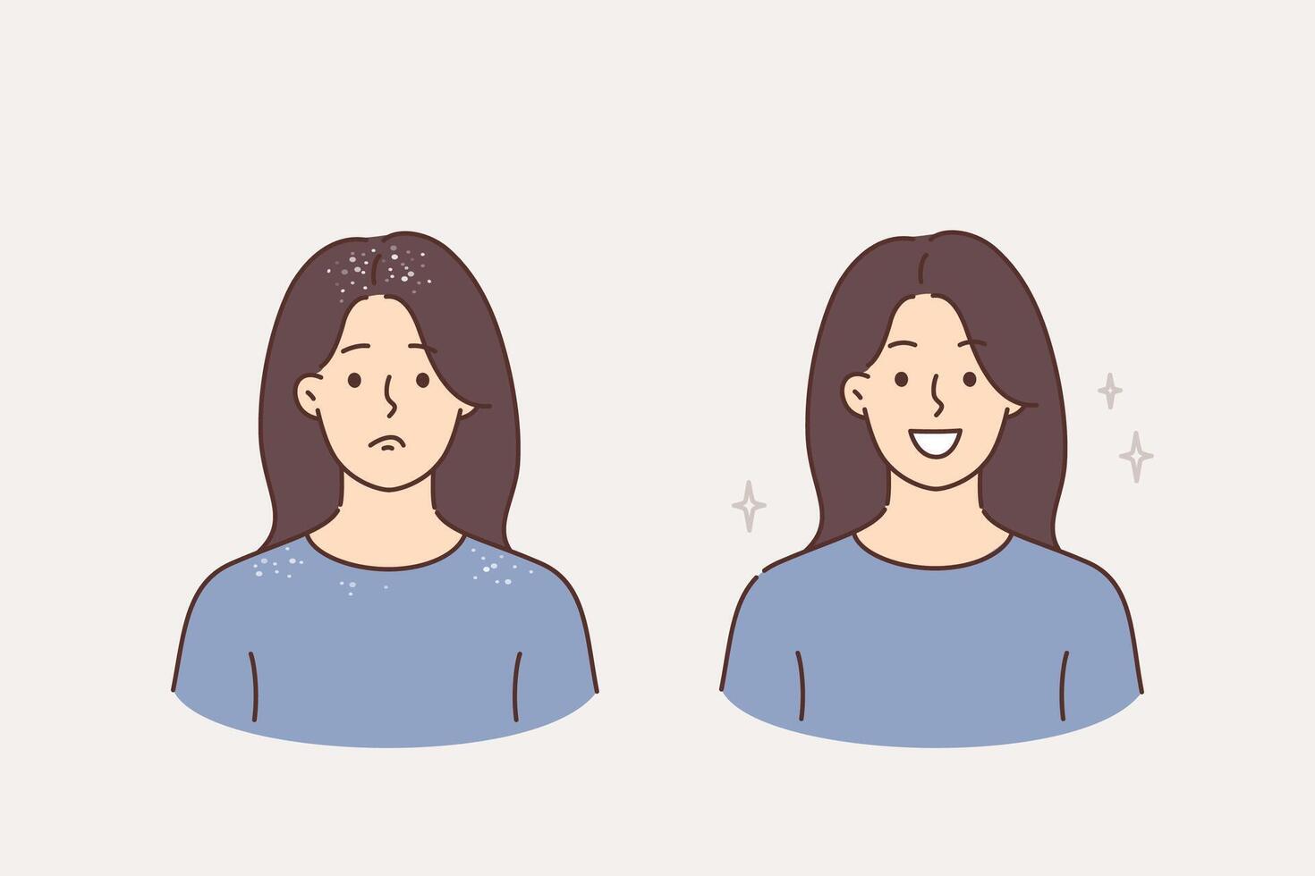 Woman with dandruff on hair is happy after using quality shampoo that allows to get good hairstyle vector