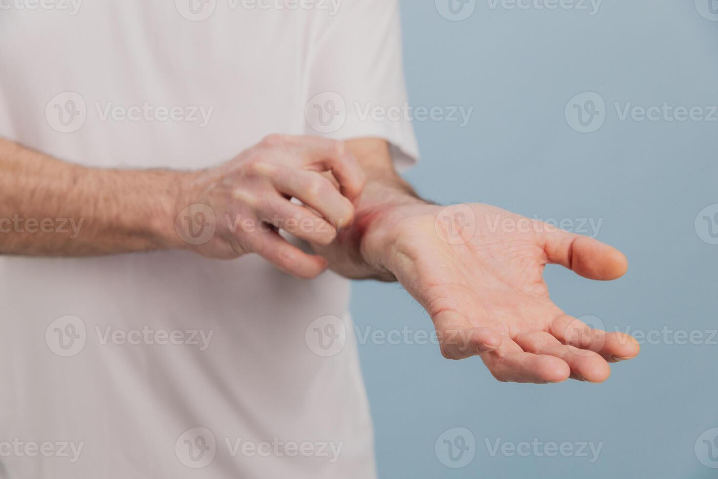 Senior man scratching itchy wrist suffering from dermatitis photo