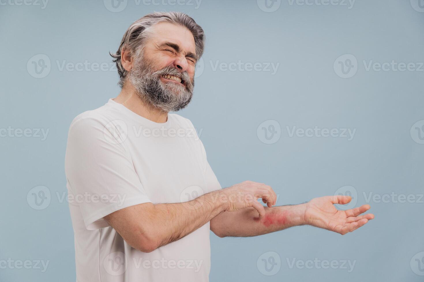 Senior man scratching itchy red rash on arm suffering from dermatitis photo