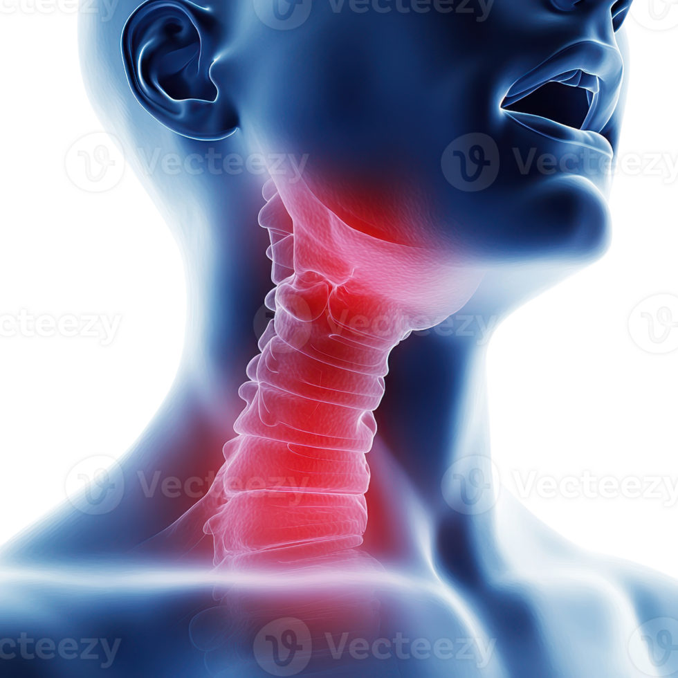 A digital illustration showing a human neck with highlighted areas, emphasizing the cervical spine and potential discomfort or injury. png