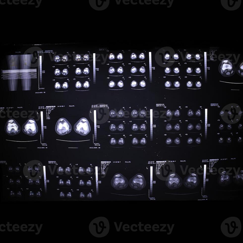 Medical Imaging Techniques Utilized in Analyzing Brain Scans for Various Diagnostic Purposes photo