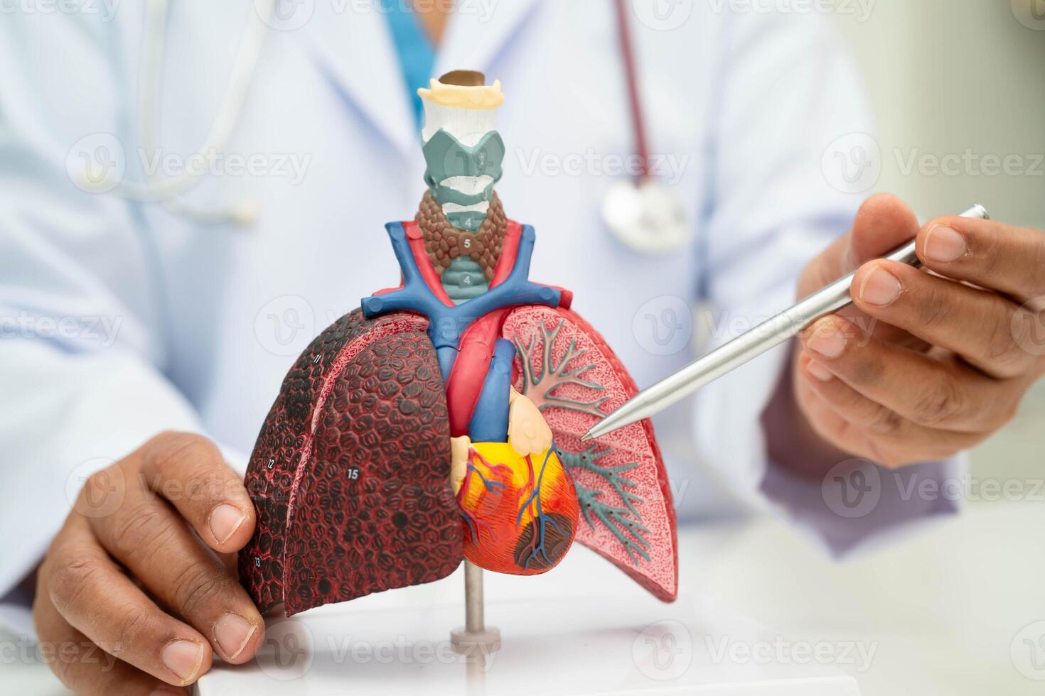 Pneumonia, lung cancer, Asian doctor holding human anatomy model for study diagnosis photo