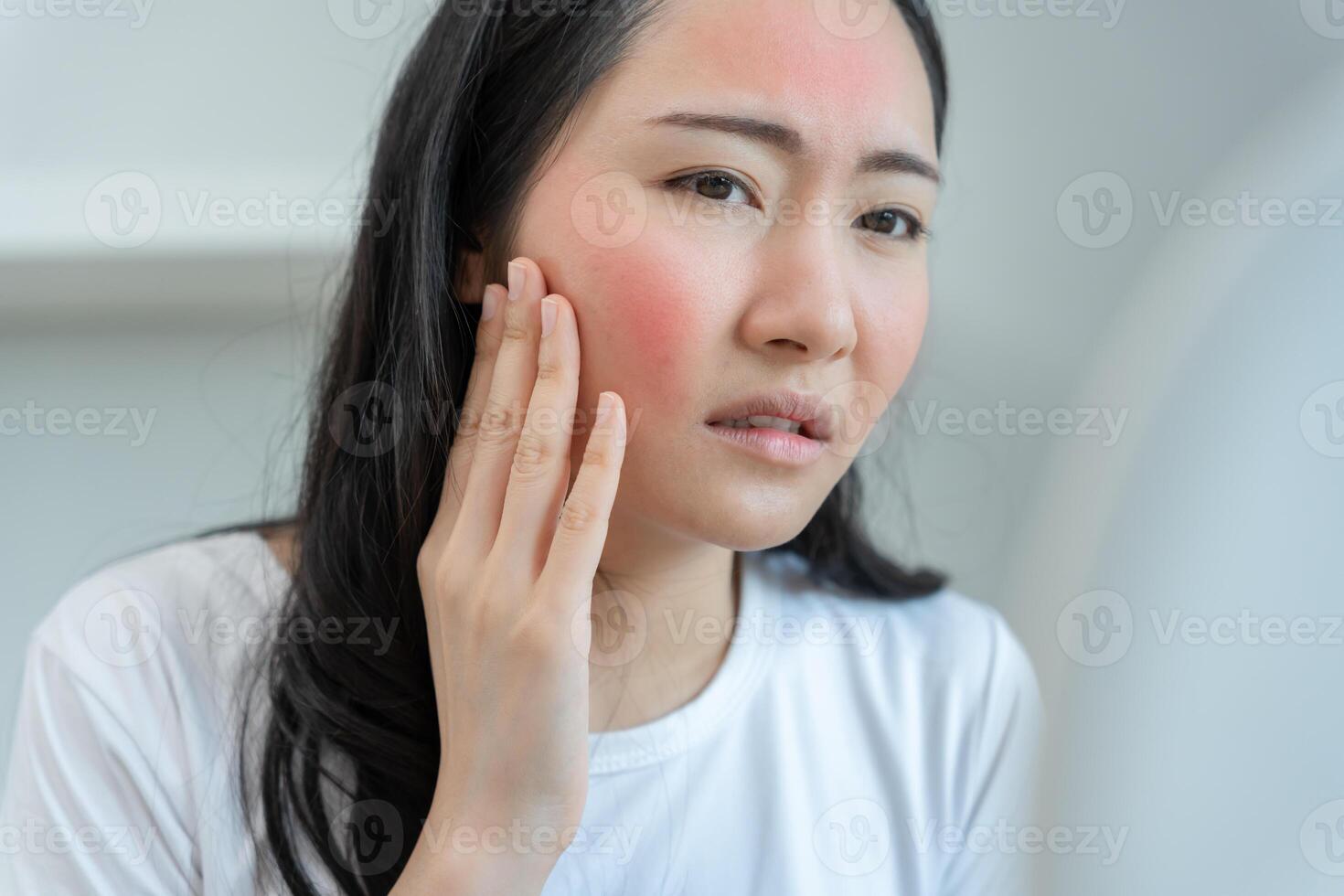 Young woman asian are worried about faces Dermatology and allergic to steroids in cosmetics. sensitive skin, red face from sunburn, acne, allergic to chemicals, rash on face. skin problem photo