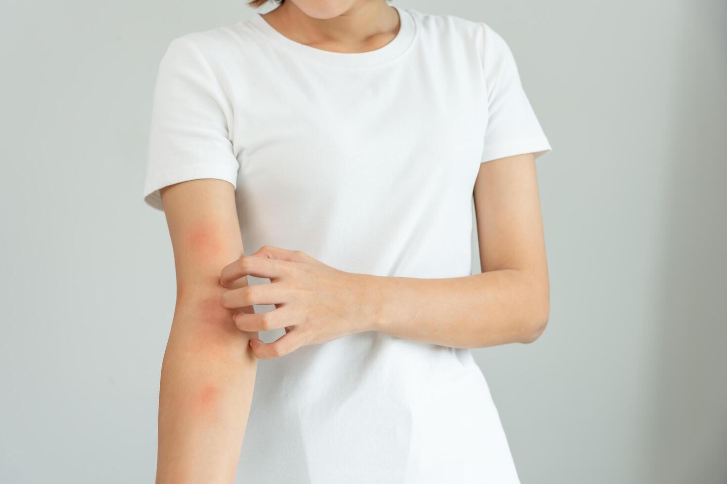 Young woman scratch body has itchy skin from skin allergic, steroid allergy, sensitive skin, red from sunburn, chemical allergy, rash, insect bites, Seborrheic Dermatitis. photo