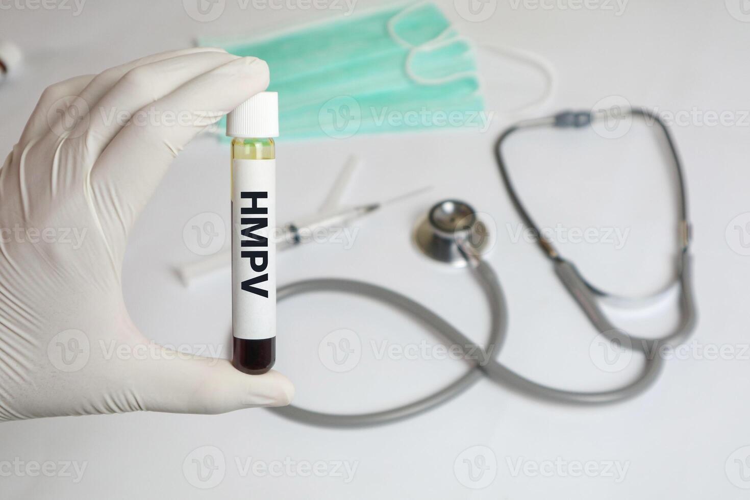 Genital warts. Blood sample to test for HPV. Human papillomavirus or HPV is a sexually transmitted infection. It causes warts on the skin and in the oral, anal and genital regions. photo