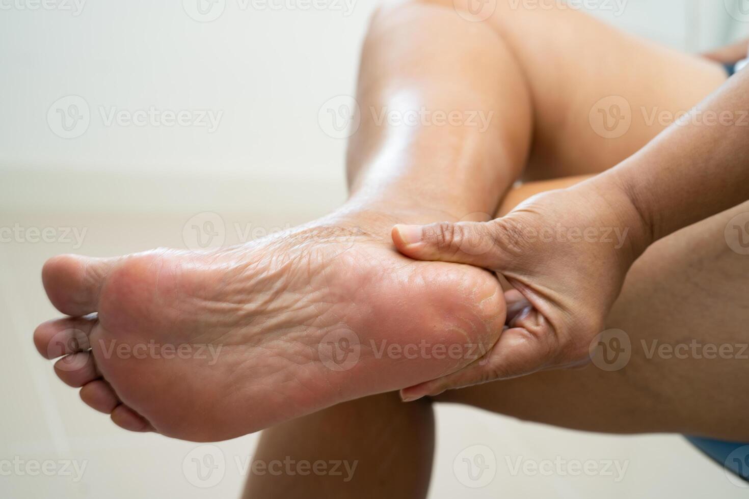 Asian woman care feet with cracked and dry heel skin cream photo