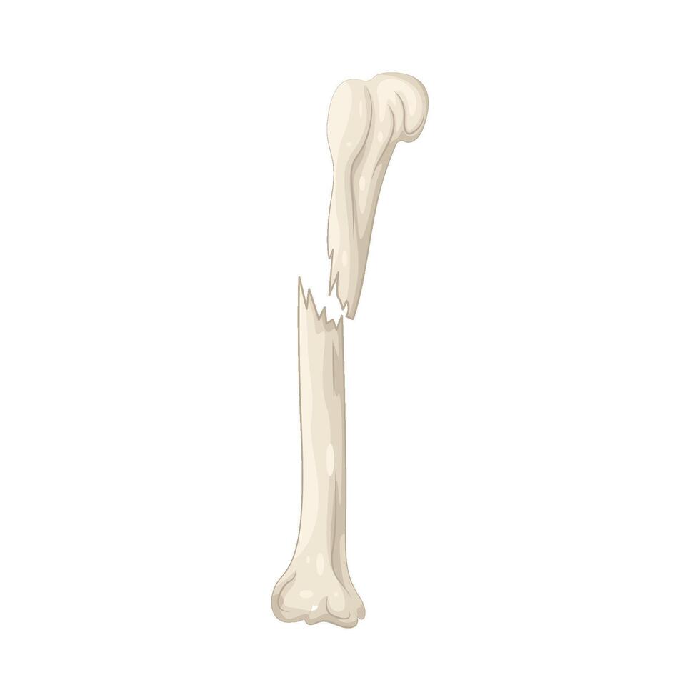 broken bones illustration vector
